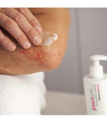 PSORIUM LOCION 400ML Inicio y  - 