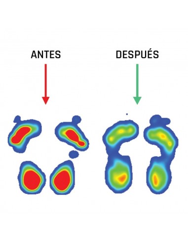 SMOU COMFORT PLANTILLA T42/43 Plantillas y Ortopedia - SMOU